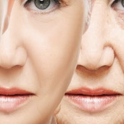 Anti-aging