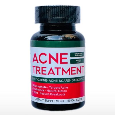 Acne treatment